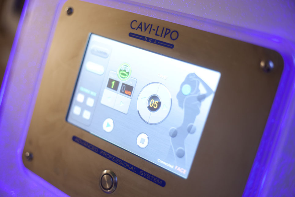 Cavi Lipo Dex - AM Cosmedic - Salon Kosmetyczny Jelenia Góra